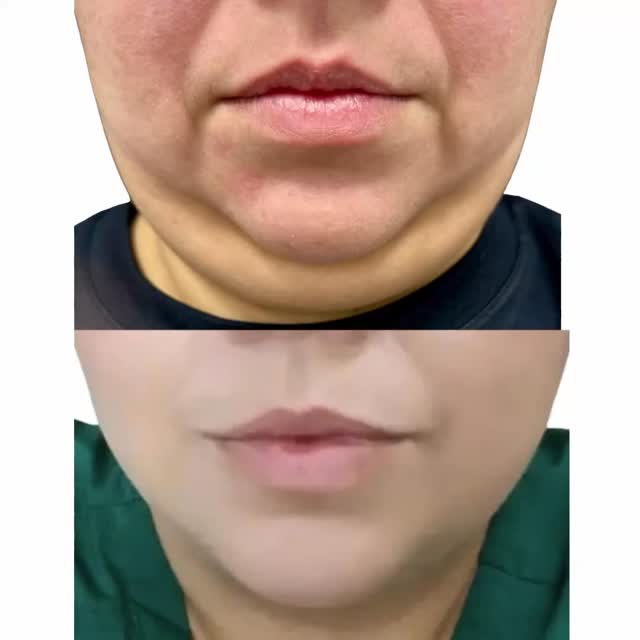 Weight loss done right. Nutrit… Weight loss done right. Nutrit…